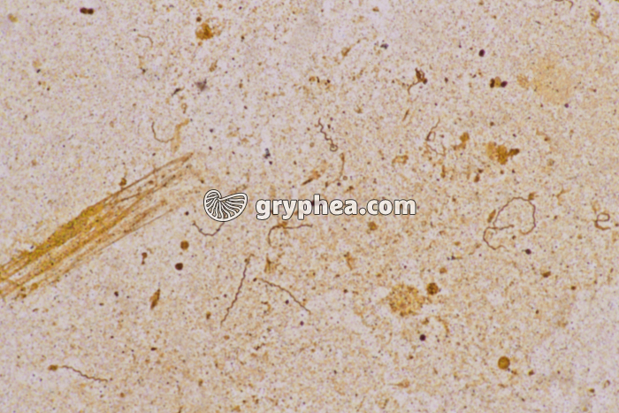 Tréponème pâle de la Syphilis (Spirochète) x100 - gryphea.org